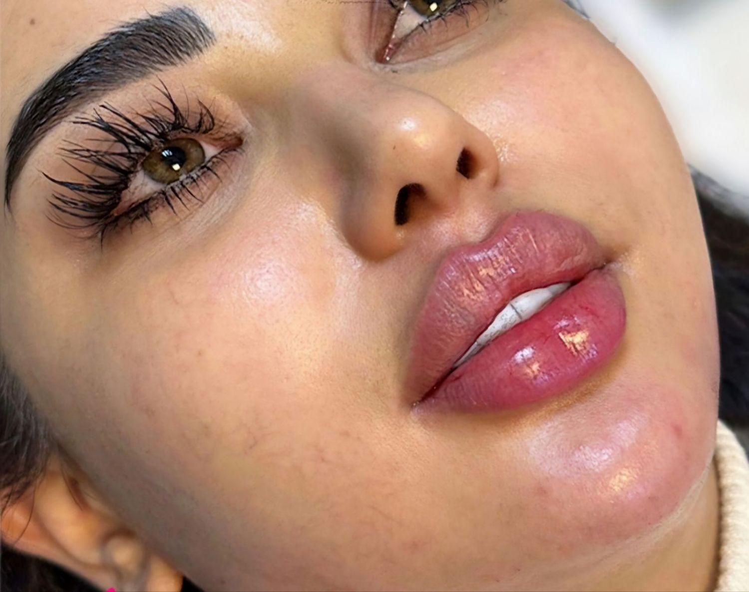 جشنواره تزریق فیلر ب مدت محدود فقط ۷۸۰تومن|خدمات آرایشگری و زیبایی|زنجان, |دیوار