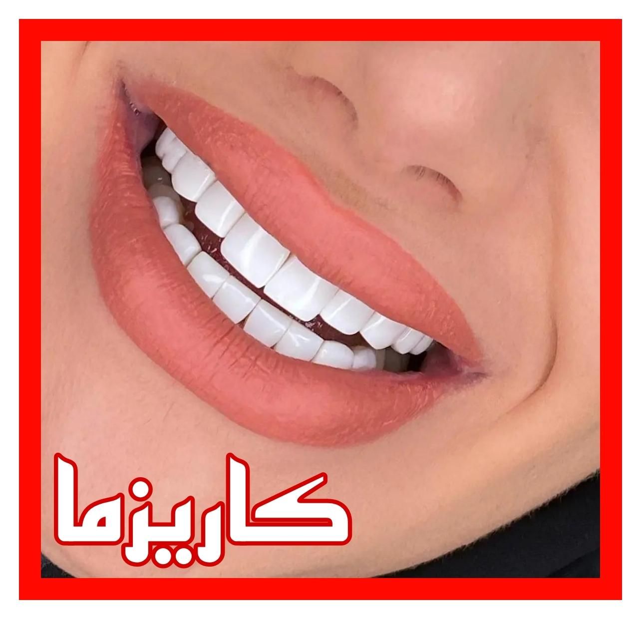 ایمپلنت عصبکشی روکش کامپوزیت ترمیم پوسیدگی دندان|خدمات آرایشگری و زیبایی|تهران, میدان ولیعصر|دیوار