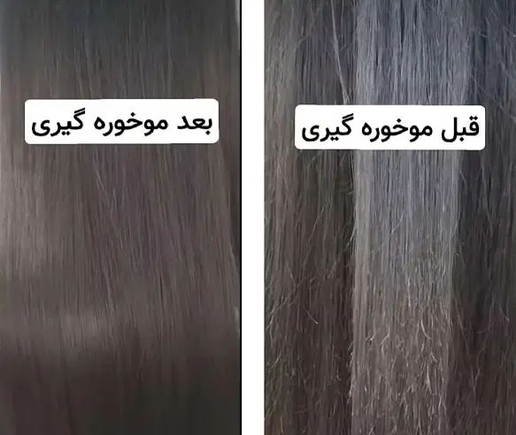 موخوره تراپی ب روش روسی بدون کوتاهی قدمو۳۰۰|خدمات آرایشگری و زیبایی|مسجد سلیمان, |دیوار