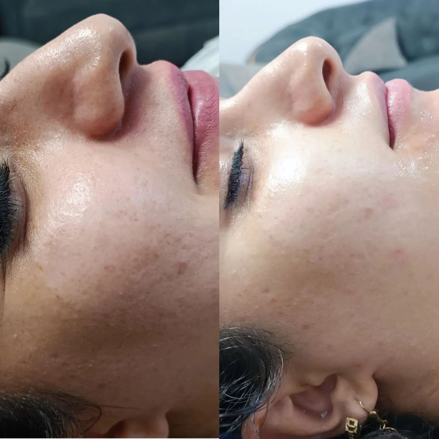 بهترین فیشیال کار در اقبال و وکیل ابادپاکسازی پوست|خدمات آرایشگری و زیبایی|مشهد, اقبال|دیوار