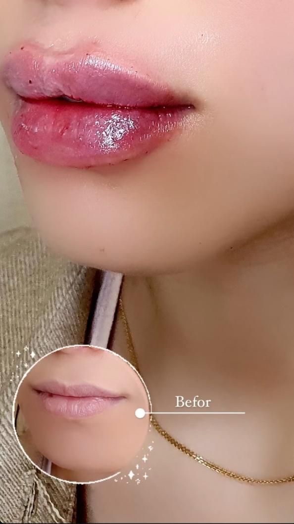 لیزر موهای زائد با قیمت باور نکردنی 550 فول بادی|خدمات آرایشگری و زیبایی|کرج, گلشهر|دیوار