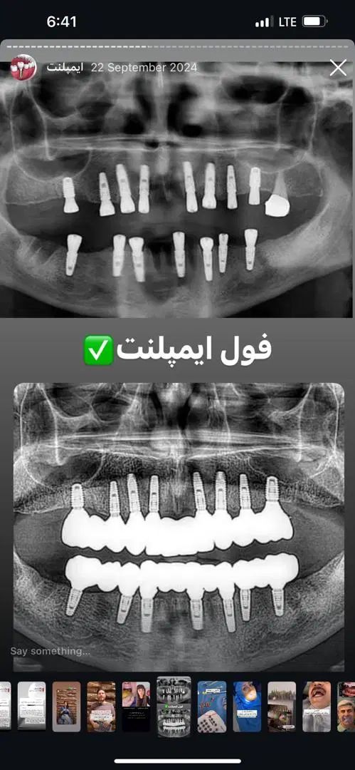 مرکز ایمپلنت شرق|خدمات آرایشگری و زیبایی|تهران, چهارصد دستگاه|دیوار