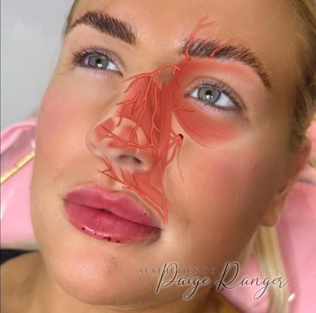 دوره آموزشی کامل بوتاکس/ژل/مزوتراپی/نخ/آنزیم|خدمات آموزشی|کرمانشاه, |دیوار