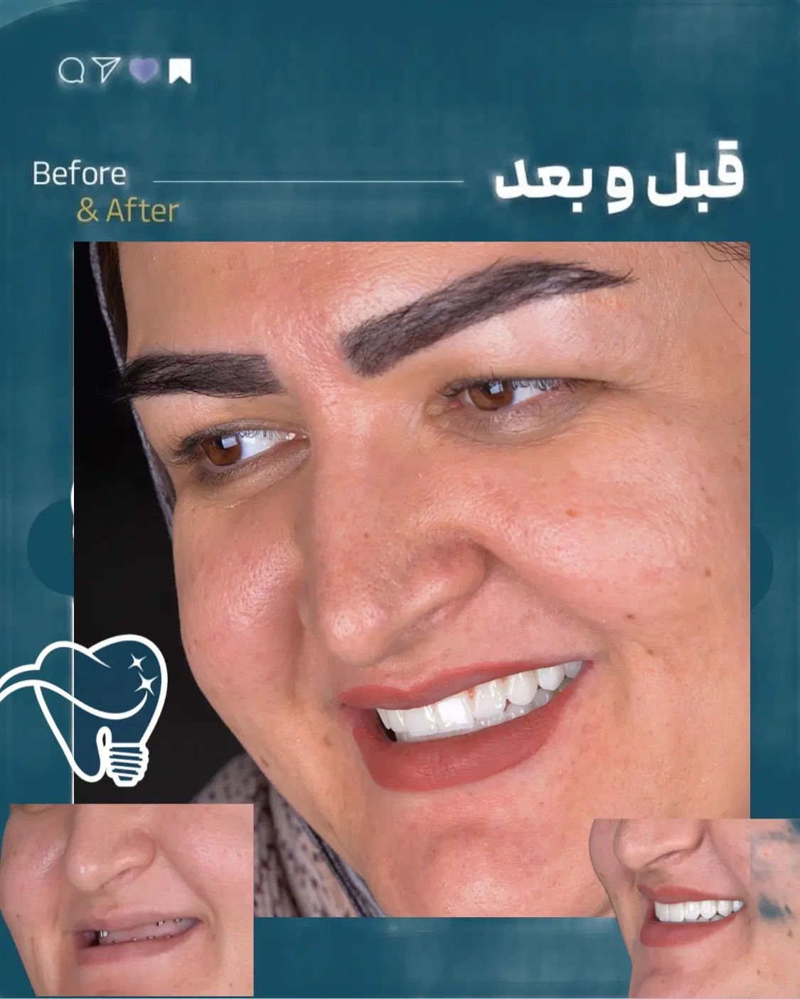 دندانپزشکی/ مرکز ایمپلنت دیجیتال 6800|خدمات آرایشگری و زیبایی|تهران, پاسداران|دیوار
