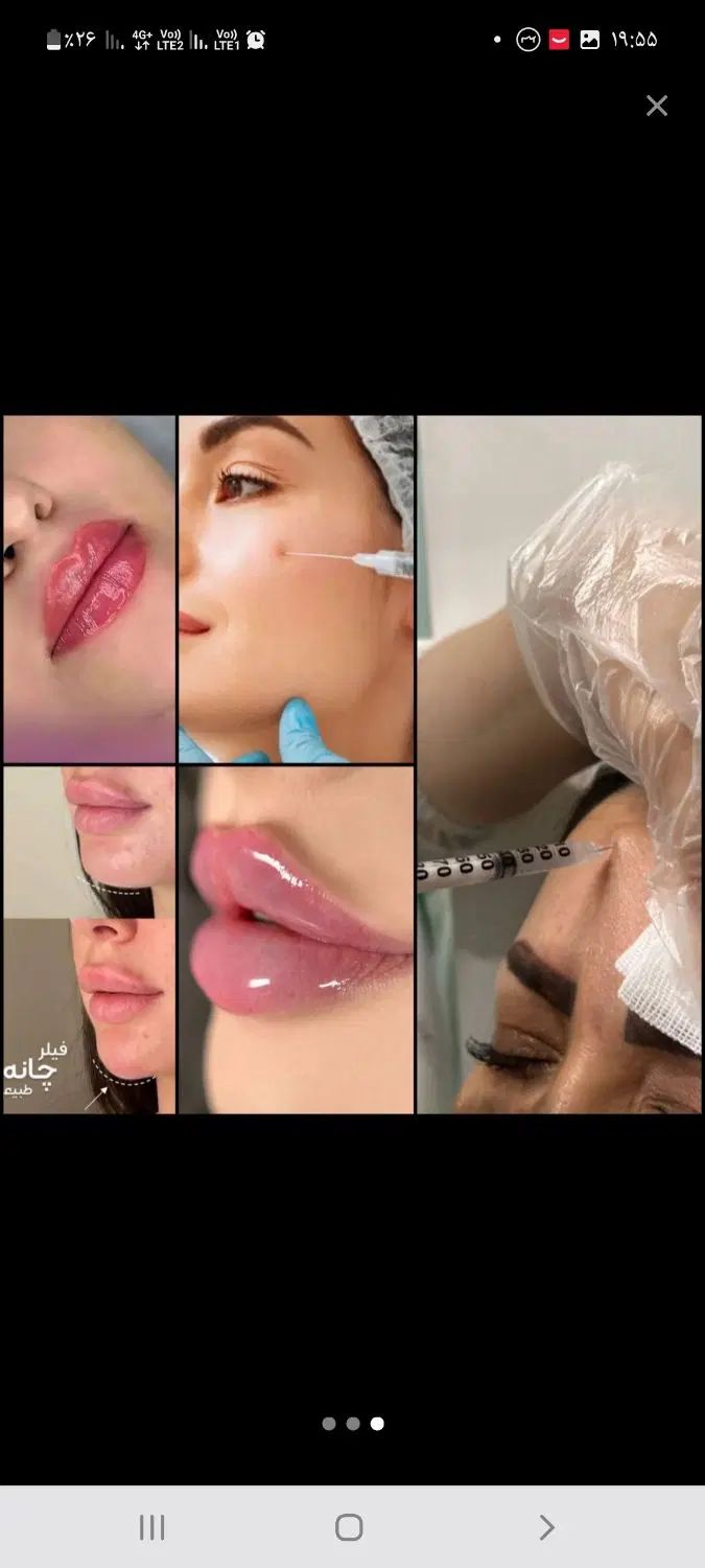 بوتاکس و ژل فیلر و پی آر پی برای خانم ها و آقایان|خدمات آرایشگری و زیبایی|بوشهر, |دیوار