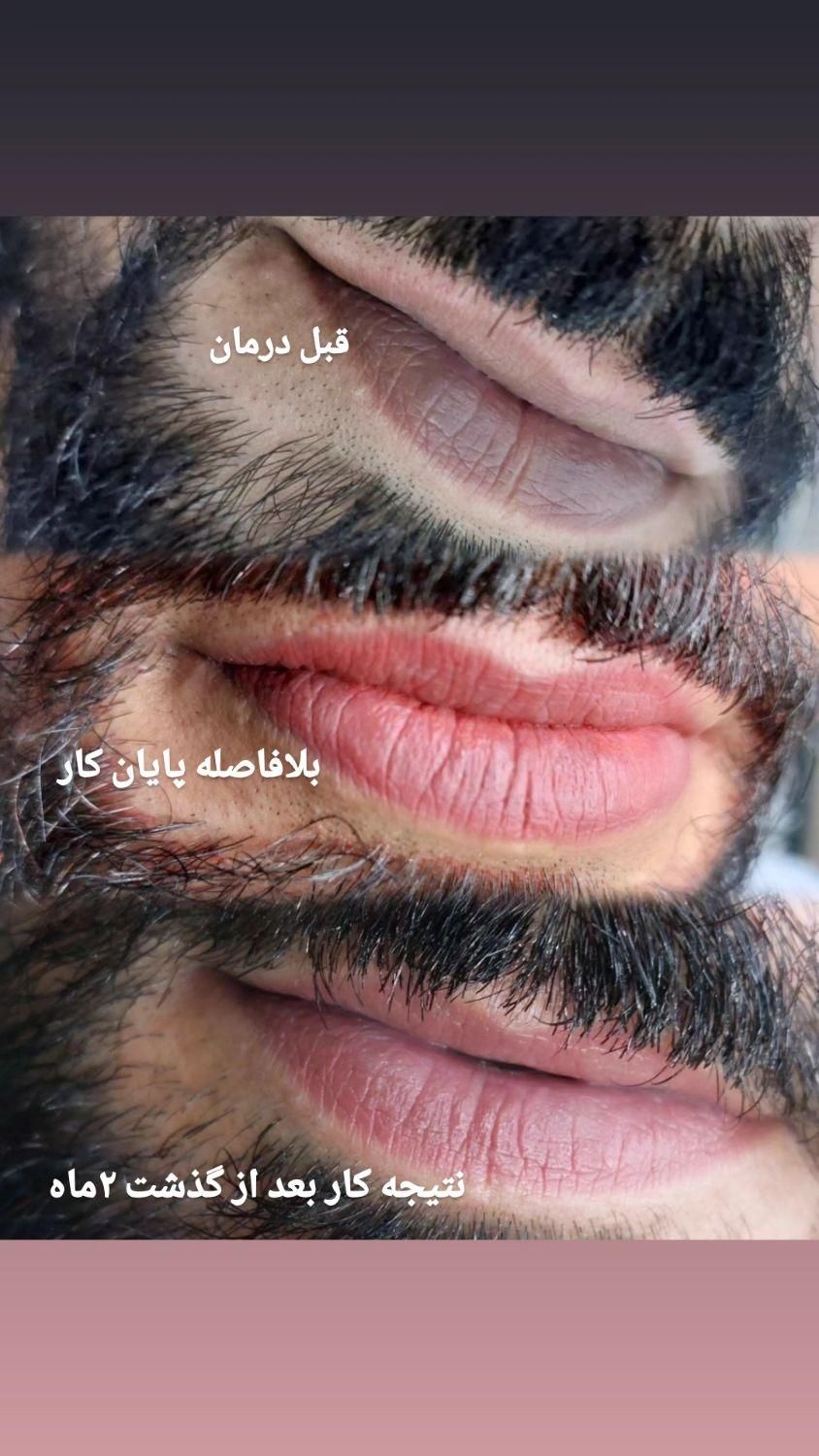 سالن تخصصی میکروپیگمنتیشن و زیبایی|خدمات آرایشگری و زیبایی|زابل, |دیوار