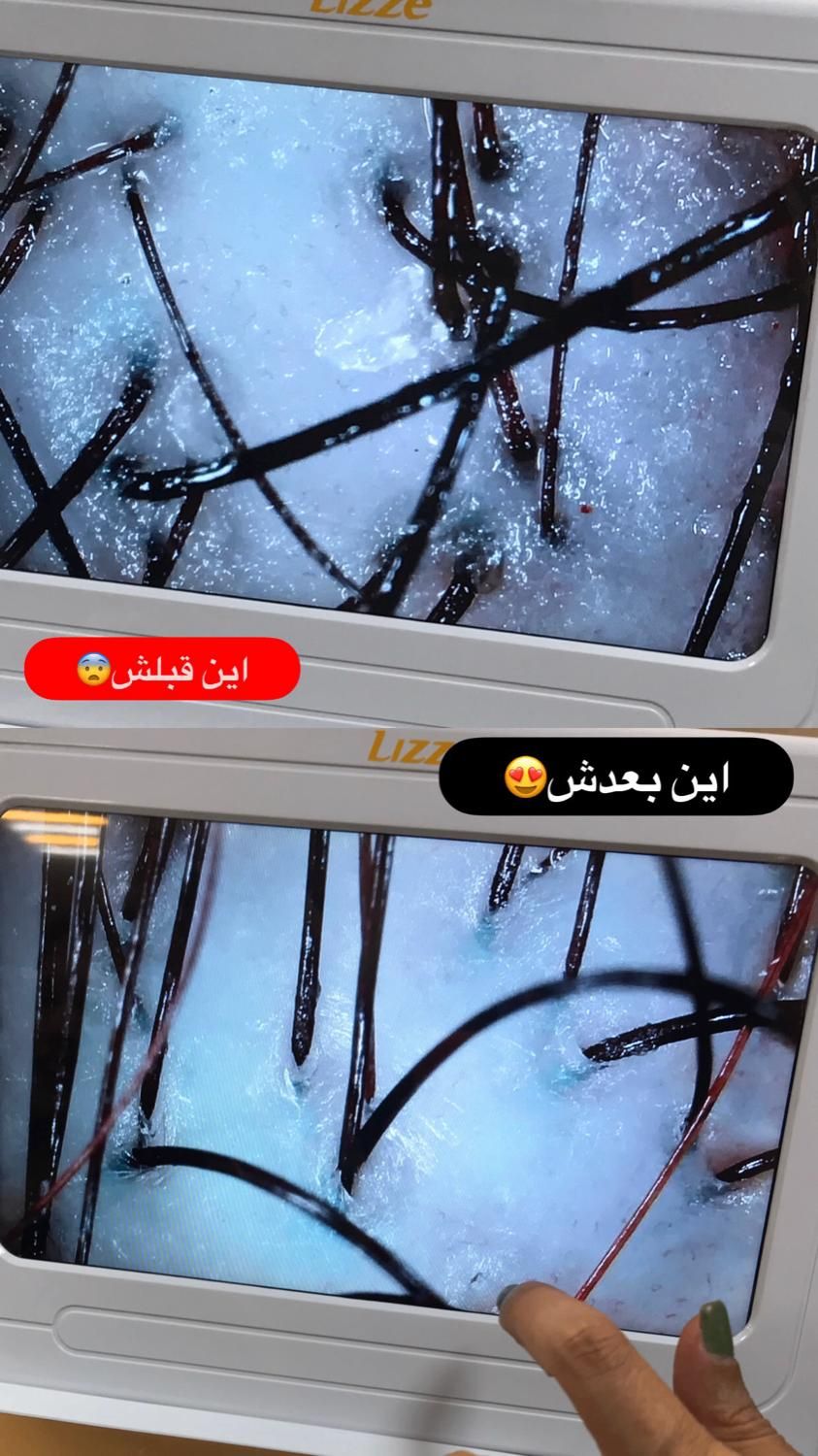 خدمات اسکراب اسکالپ|خدمات آرایشگری و زیبایی|رشت, گلباغ نماز|دیوار
