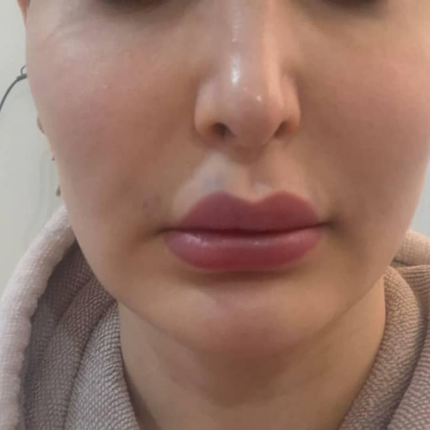 جوانساز پوست|خدمات آرایشگری و زیبایی|کرج, شهرک ظفر|دیوار