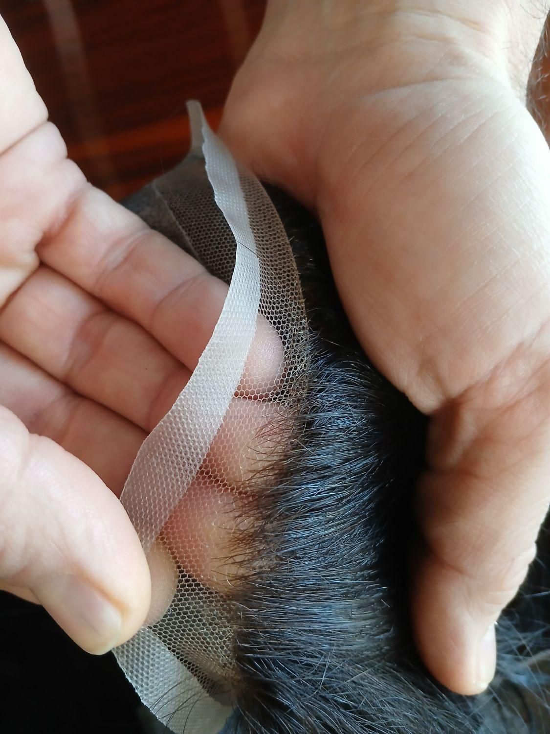 پروتز موی مردانه|آرایشی، بهداشتی، درمانی|تبریز, |دیوار