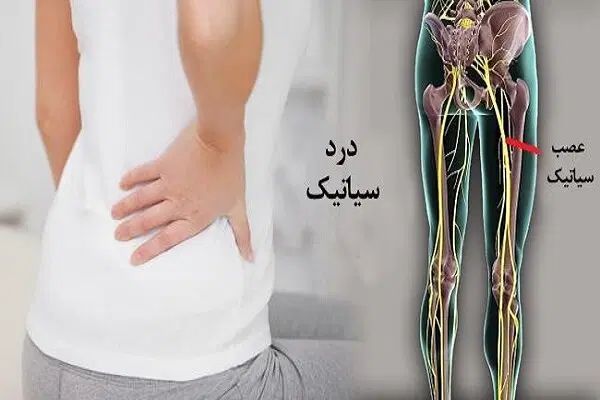 درمان دیسک ،سیاتیک،کتف و گردن،زانو و شکسته بندی|خدمات آرایشگری و زیبایی|تبریز, |دیوار