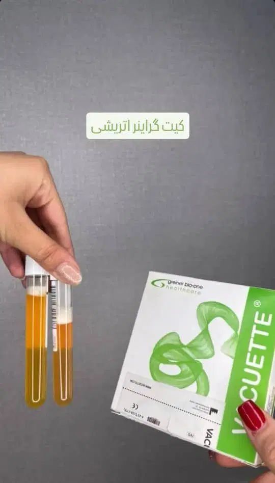 دستگاه سانتریفیوژ پزشکی - PRP و کار چربی|پزشکی|مشهد, جانباز|دیوار