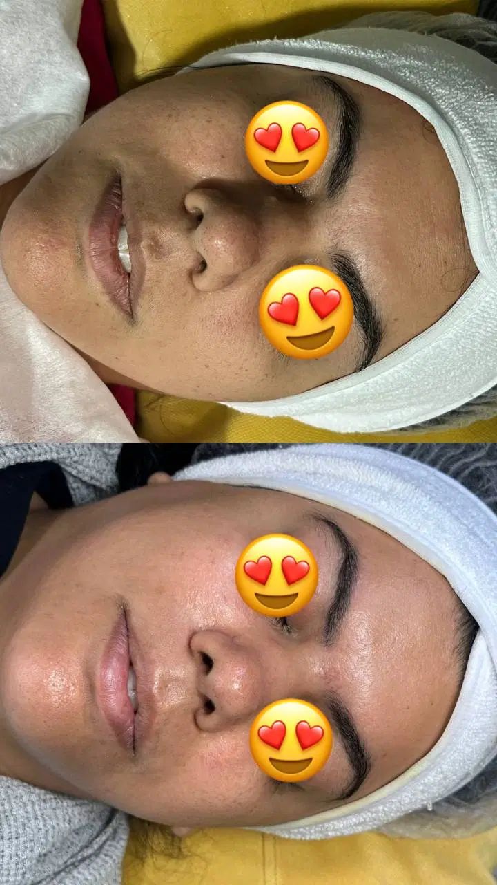 فیشیال و تجویز روتین پوستی اختصاصی رایگان|خدمات آرایشگری و زیبایی|یزد, |دیوار