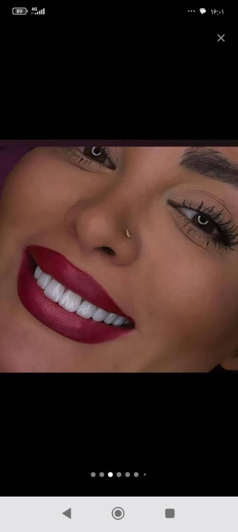 دندانپزشکی عصب کشی ،روکش،ایمپلنت،کامپوزیت|خدمات آرایشگری و زیبایی|بروجرد, |دیوار