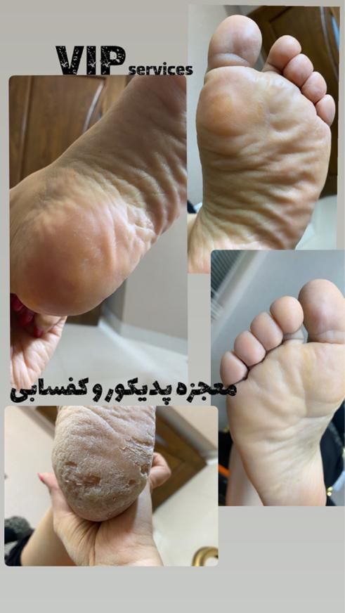 خدمات کفسابی و پدیکور (درمانی و زیبایی )پا|خدمات آرایشگری و زیبایی|مشهد, وکیل‌آباد|دیوار