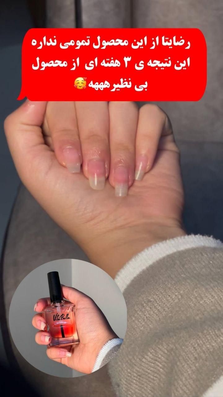 لوسیون تقویت کننده ناخن|آرایشی، بهداشتی، درمانی|رشت, منظریه|دیوار