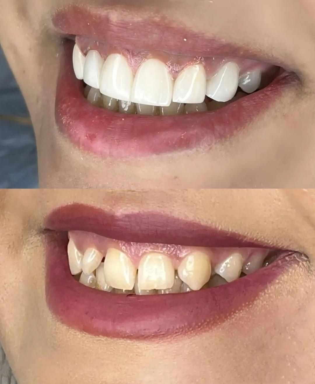 آموزش حرفه ای کار درمانی و زیبایی دندانپزشکی|خدمات آموزشی|تهران, مهرآباد جنوبی|دیوار