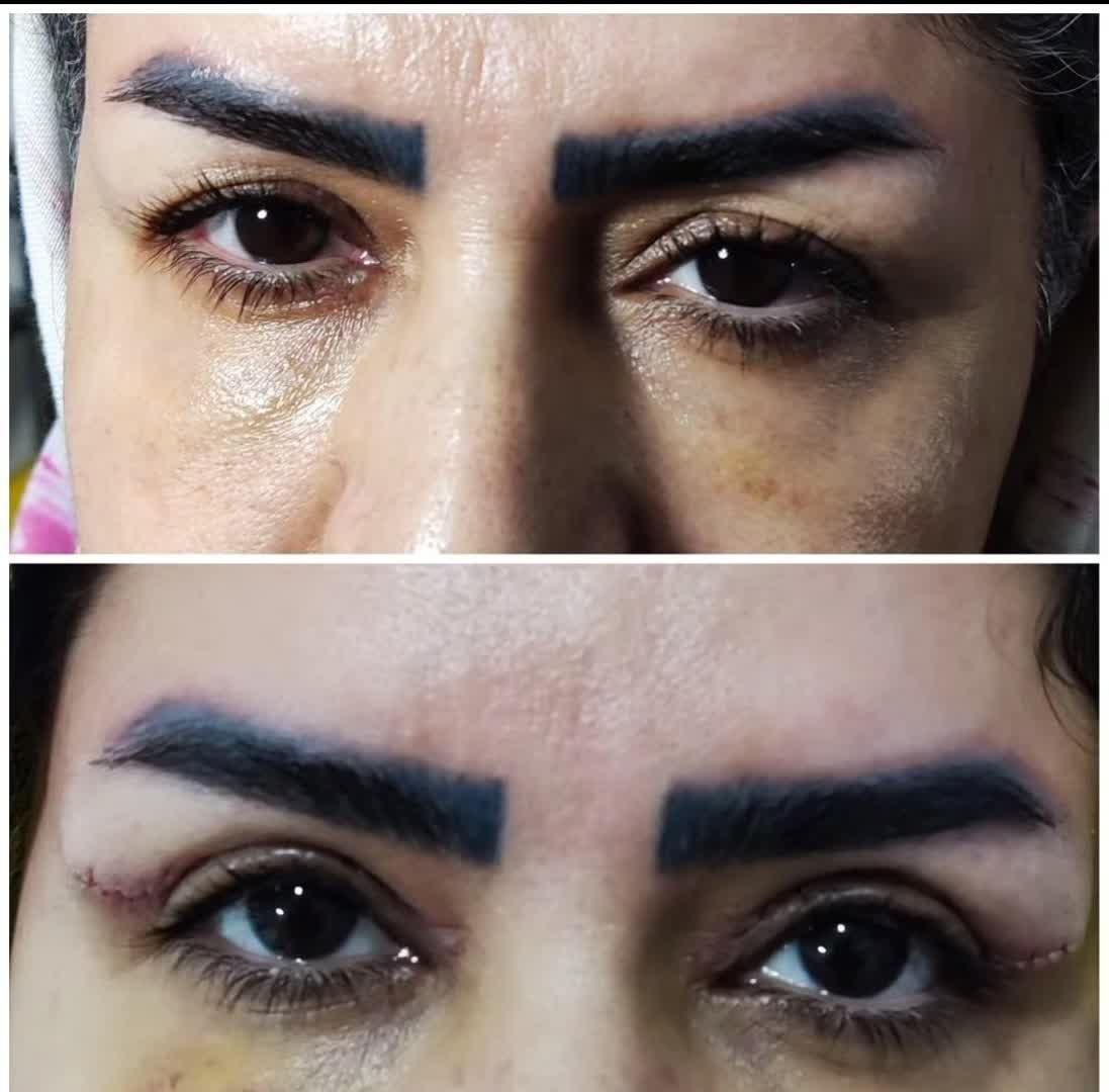 مرکز تخصصی جراحی بلفارو پلاستی دکتر الماس اسدی|خدمات آرایشگری و زیبایی|کرمانشاه, |دیوار