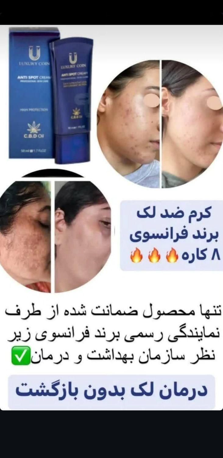 کرم ضد لک لاکچری کوین فرانسه|آرایشی، بهداشتی، درمانی|آستانه اشرفیه, |دیوار