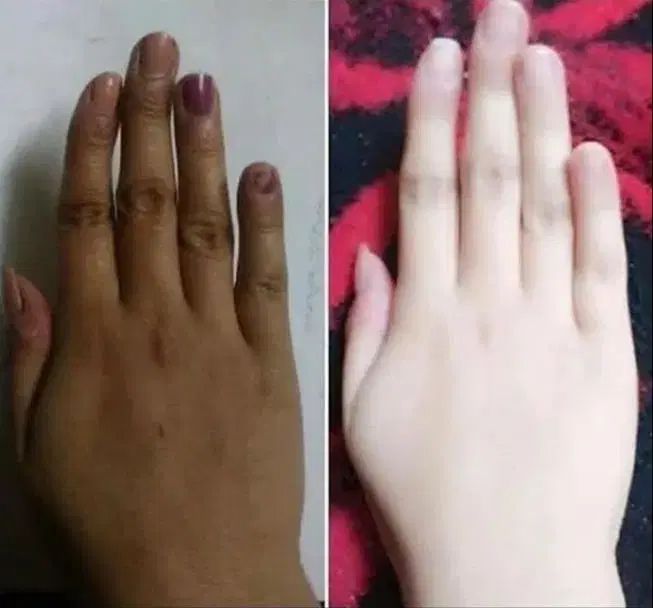 فرمول کرم ضدلک وسفیدکننده دست و صورت وبدن|آرایشی، بهداشتی، درمانی|ایرانشهر, |دیوار