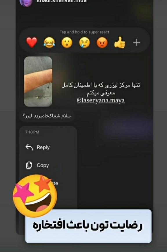 ۳۵۰،۰۰۰ت اعتبارهدیه باشگاه یانا و مایا(لیزر کندلا)|خدمات آرایشگری و زیبایی|شوش, |دیوار