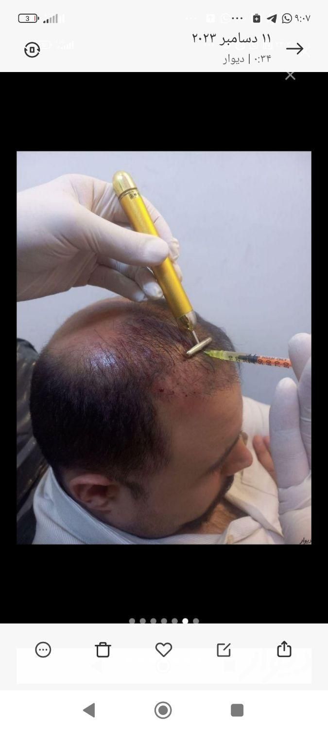 ژل بوتاکس لیزر مزو پی آر پی خالیرداری جوانسازی|خدمات آرایشگری و زیبایی|تهران, افسریه|دیوار