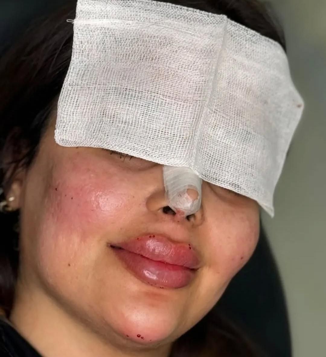 جشنواره ویژه ژل و بوتاکس|خدمات آرایشگری و زیبایی|اردبیل, |دیوار