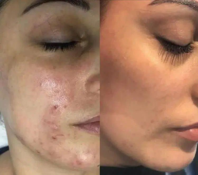 جشنواره ویژه تخصصی فیشال ففط فقط تا اول مهرماه|خدمات آرایشگری و زیبایی|تهران, مدائن|دیوار
