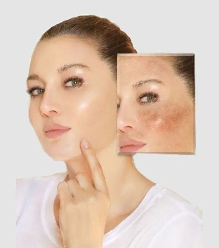ضد افتاب|آرایشی، بهداشتی، درمانی|کرج, اخترآباد|دیوار
