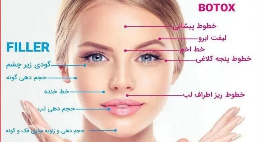 آموزش کاشت مو فیلر ژل بوتاکس نخ لیفت لیزر مو فشیال|خدمات آموزشی|اصفهان, ملک‌شهر|دیوار