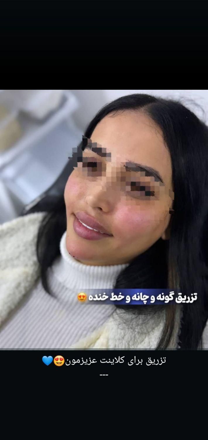 زیبایی ژل و بوتاکس|خدمات آرایشگری و زیبایی|اهواز, کیان اباد|دیوار