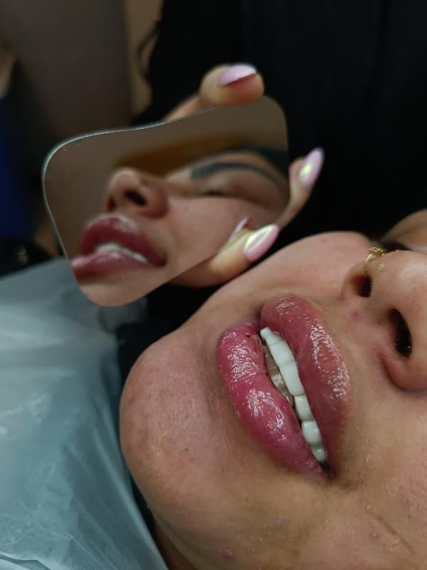 جشنواره دندان ونیر کامپوزیت روکش لمینیت عصب  IMAX|خدمات آرایشگری و زیبایی|تهران, هفت حوض|دیوار