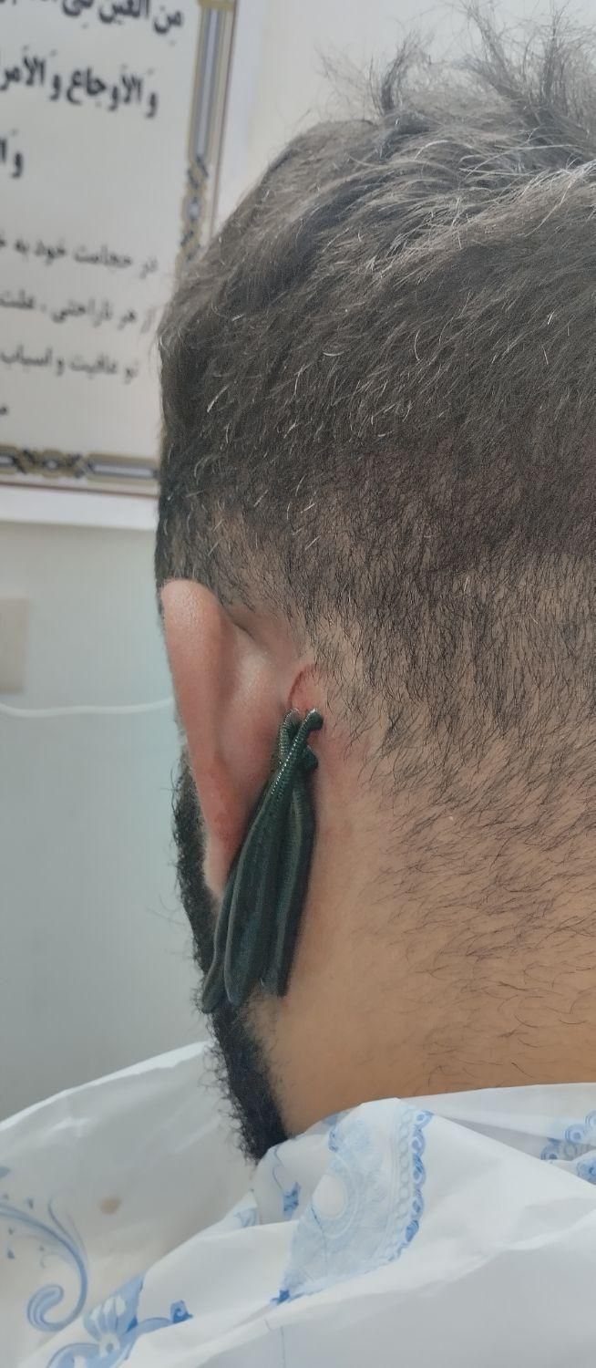 طب سنتی سیاتیک کمر درد دیسک بادکش حجامت زالو فصد|خدمات آرایشگری و زیبایی|ملارد, |دیوار