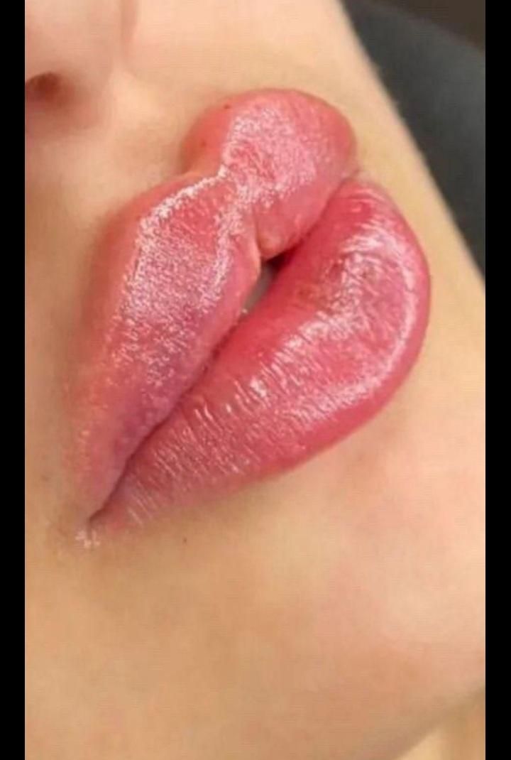 بوتاکس،تزریق ژل،مزوزیرچشم وصورت ،پرسینگ محمدشهر|خدمات آرایشگری و زیبایی|محمدشهر, محمدشهر|دیوار