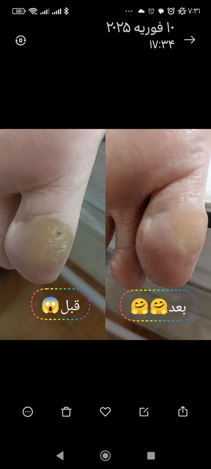 پدیکوریست خاص/ترک/پینه/قوزک|خدمات آرایشگری و زیبایی|قم, سالاریه|دیوار