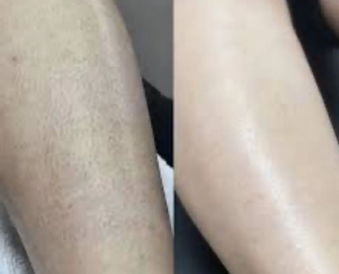اپیلاسیون و اصلاح ابرو و اکستنش مو حتی جمعه|خدمات آرایشگری و زیبایی|کرمان, |دیوار