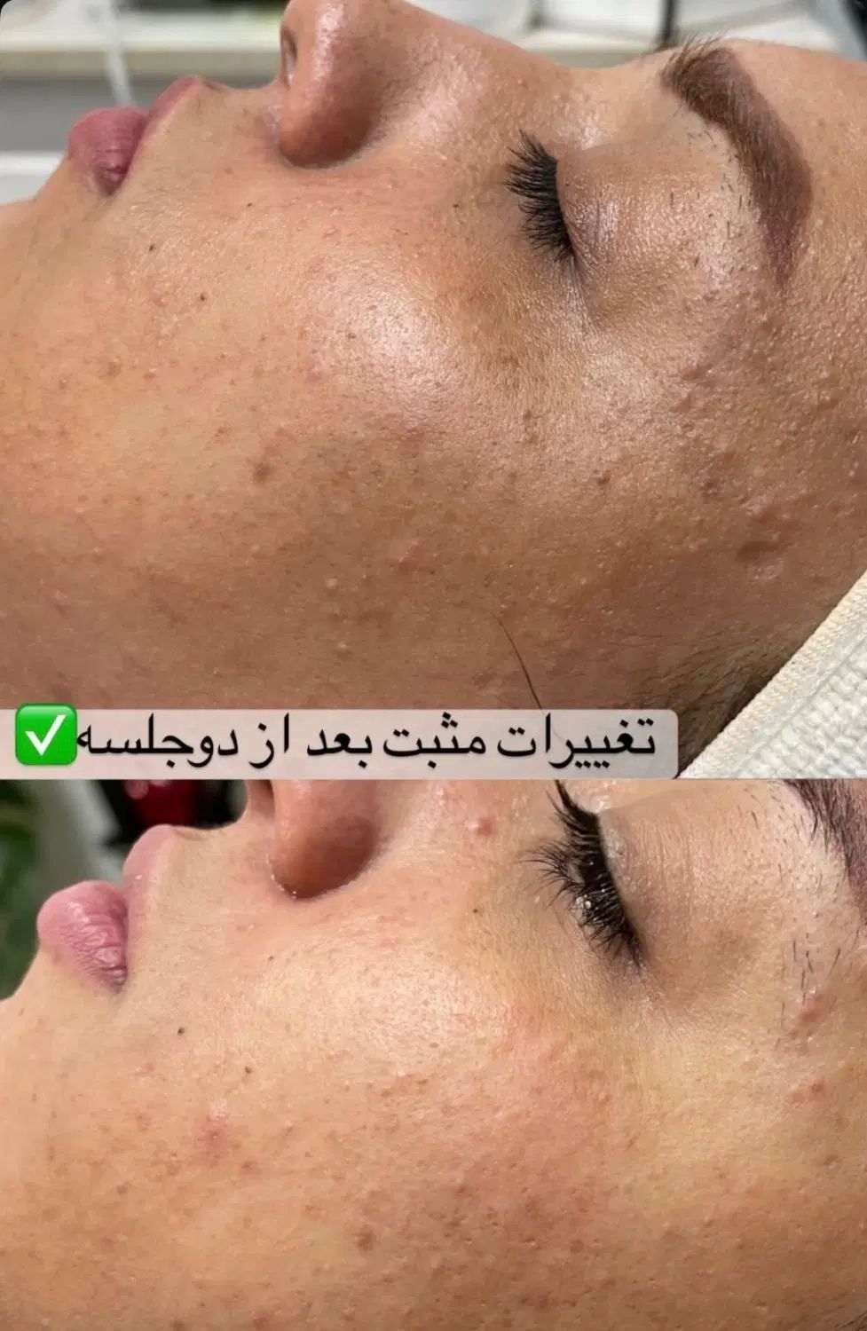 تخفیف ۵۰ ٪فیشیال ( بانوان) آنوبیس  اکلادو  هرموس|خدمات آرایشگری و زیبایی|مشهد, سجاد شهر|دیوار