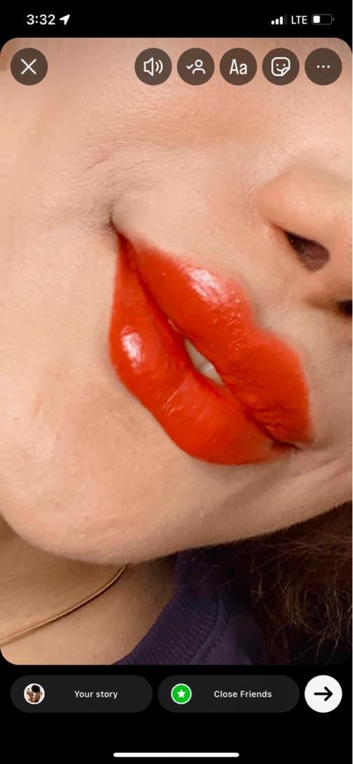 تزریق ژل و بوتاکس و فیلر بادی|خدمات آرایشگری و زیبایی|تبریز, |دیوار