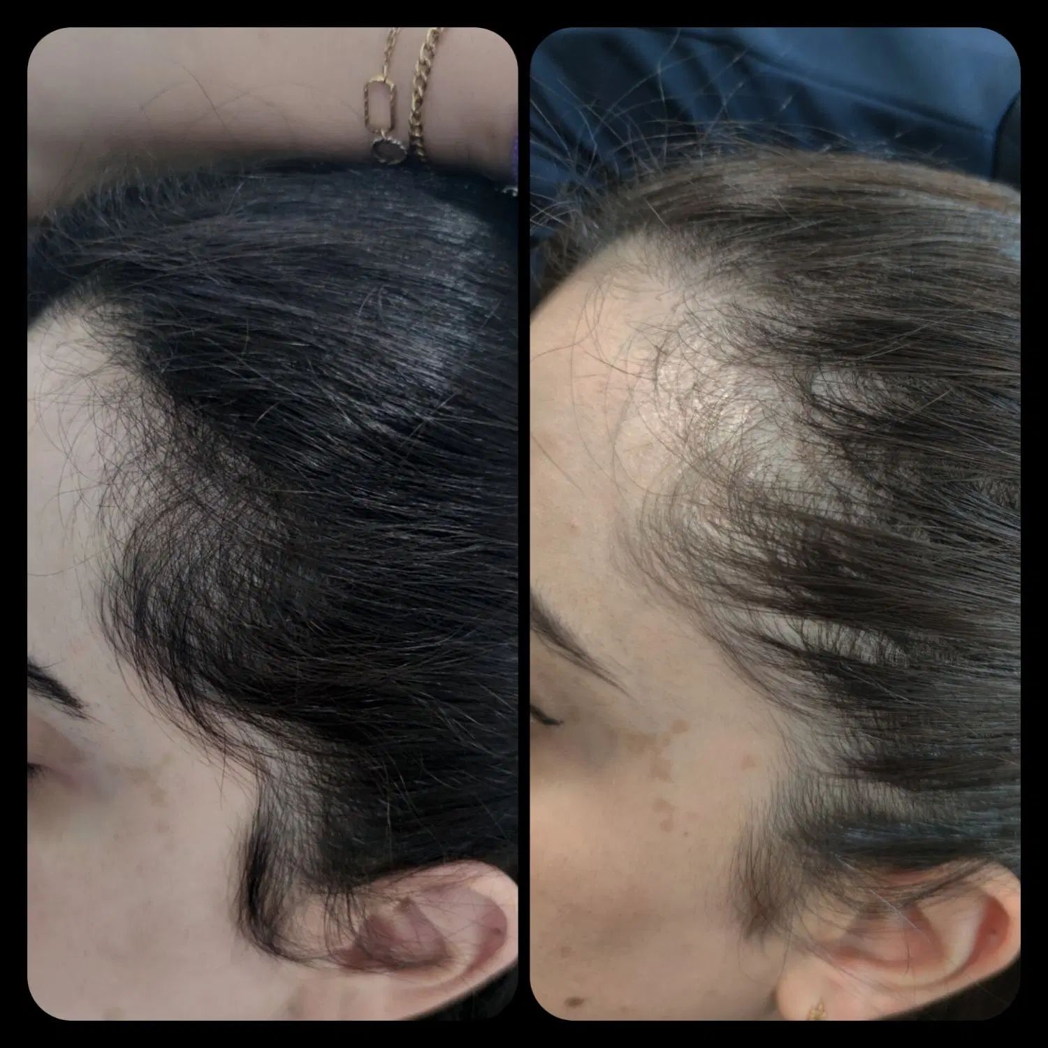 استخدام دستیار کراتین و اسکراب اسکالپ|استخدام درمانی، زیبایی، بهداشتی|تهران, اقدسیه|دیوار