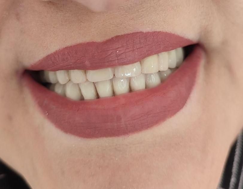 دندانسازی بانو دنت.با چک|خدمات آرایشگری و زیبایی|تربت‌حیدریه, داروپخش|دیوار