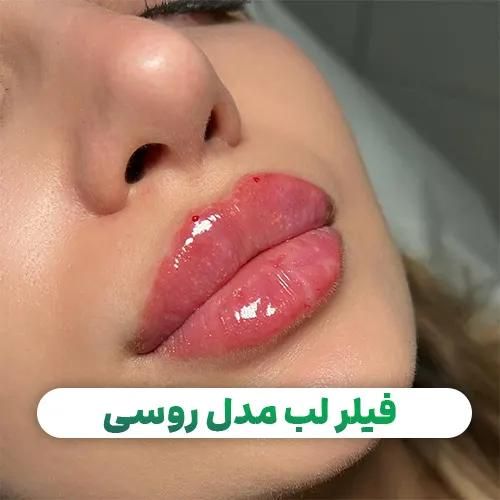 تخفیف ژل و بوتاکس|خدمات آرایشگری و زیبایی|تهران, صادقیه|دیوار