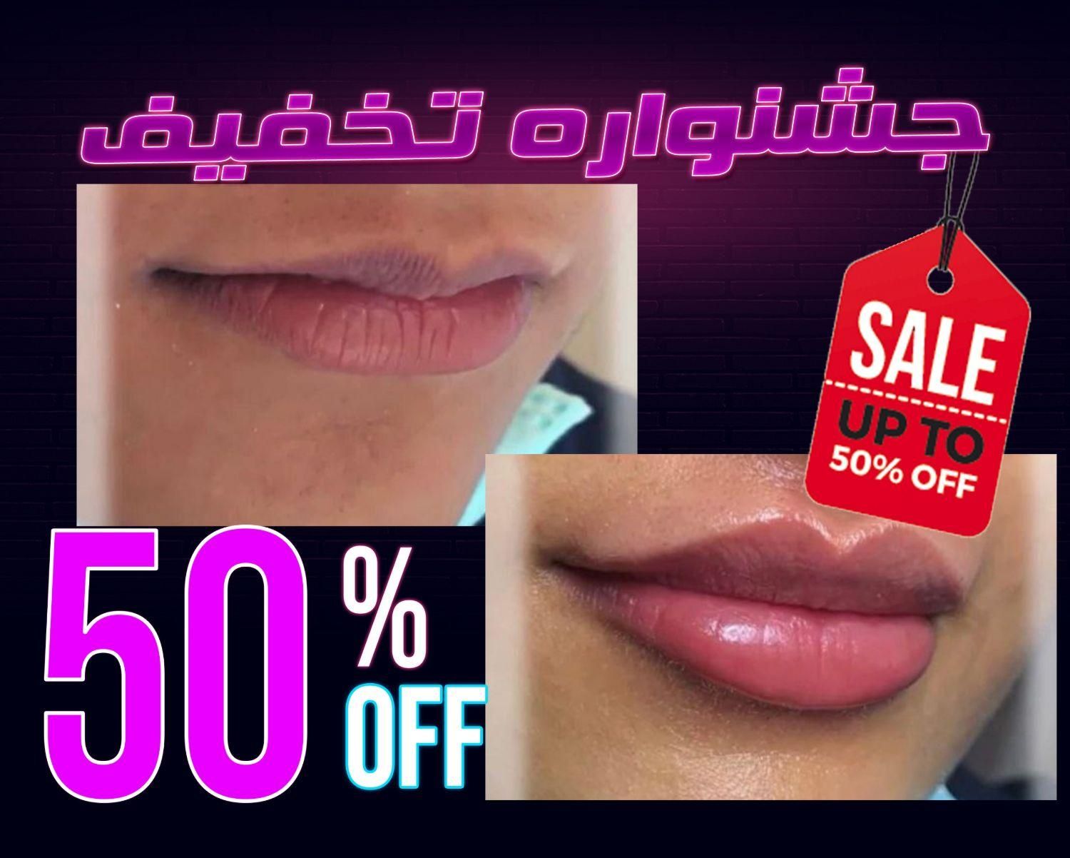 تخفیف تزریق ژل بوتاکس لیفت نخ هایفو فیلرلب لیزر|خدمات آرایشگری و زیبایی|تهران, سعادت‌آباد|دیوار