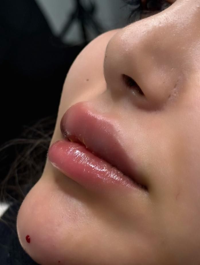 ژل و بوتاکس کلینیک زیبایی دکترفرشیدکریمی|خدمات آرایشگری و زیبایی|کرمانشاه, |دیوار