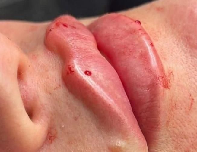 ژل فیلر آنزیم بوتاکس ناخن|خدمات آرایشگری و زیبایی|مرودشت, فرهنگ|دیوار