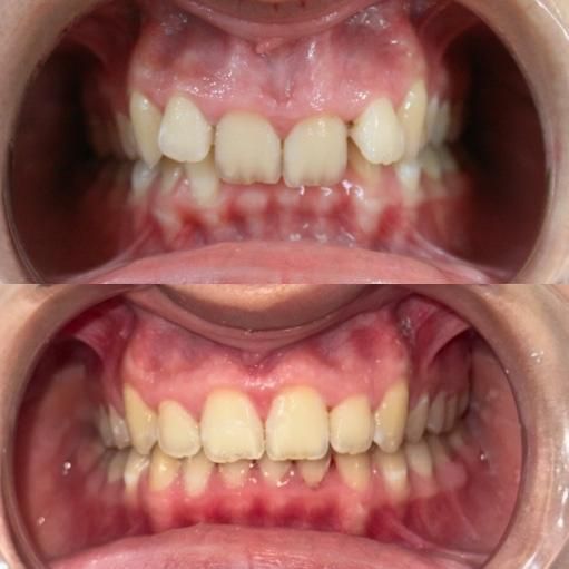 ارتودنسی با شرایط اقساط و منعطف|خدمات آرایشگری و زیبایی|تهران, دزاشیب|دیوار