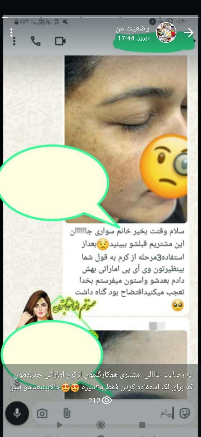کرم روشن کننده صورت وبدن ضدلک(اماراتی)vip|آرایشی، بهداشتی، درمانی|اهواز, شریعتی جنوبی|دیوار