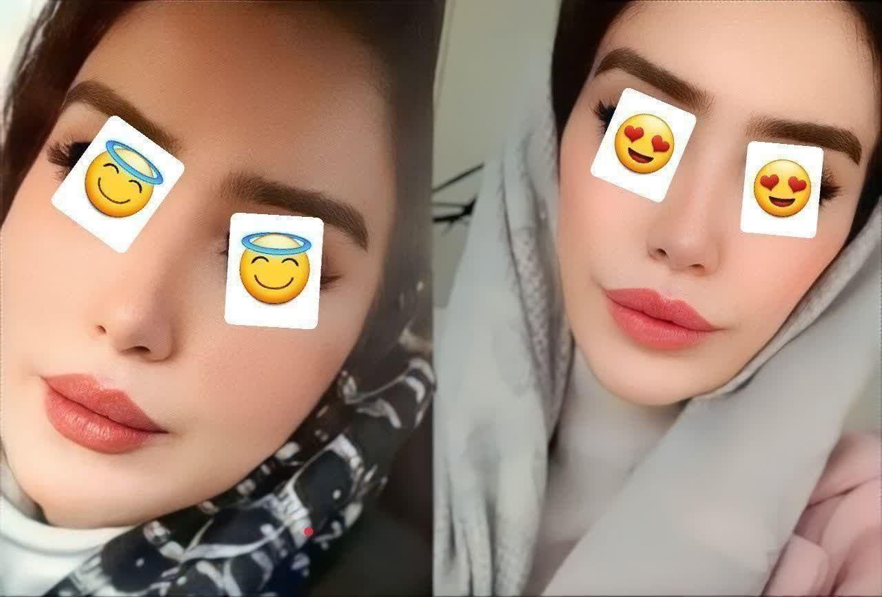 فروش جوانه گندم اصل برند بین استار|آرایشی، بهداشتی، درمانی|بانه, |دیوار