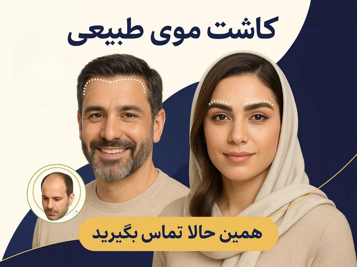 پیوند/ مو ابرو / روش DHI / با خط رویش پنهان|خدمات آرایشگری و زیبایی|تهران, دروس|دیوار