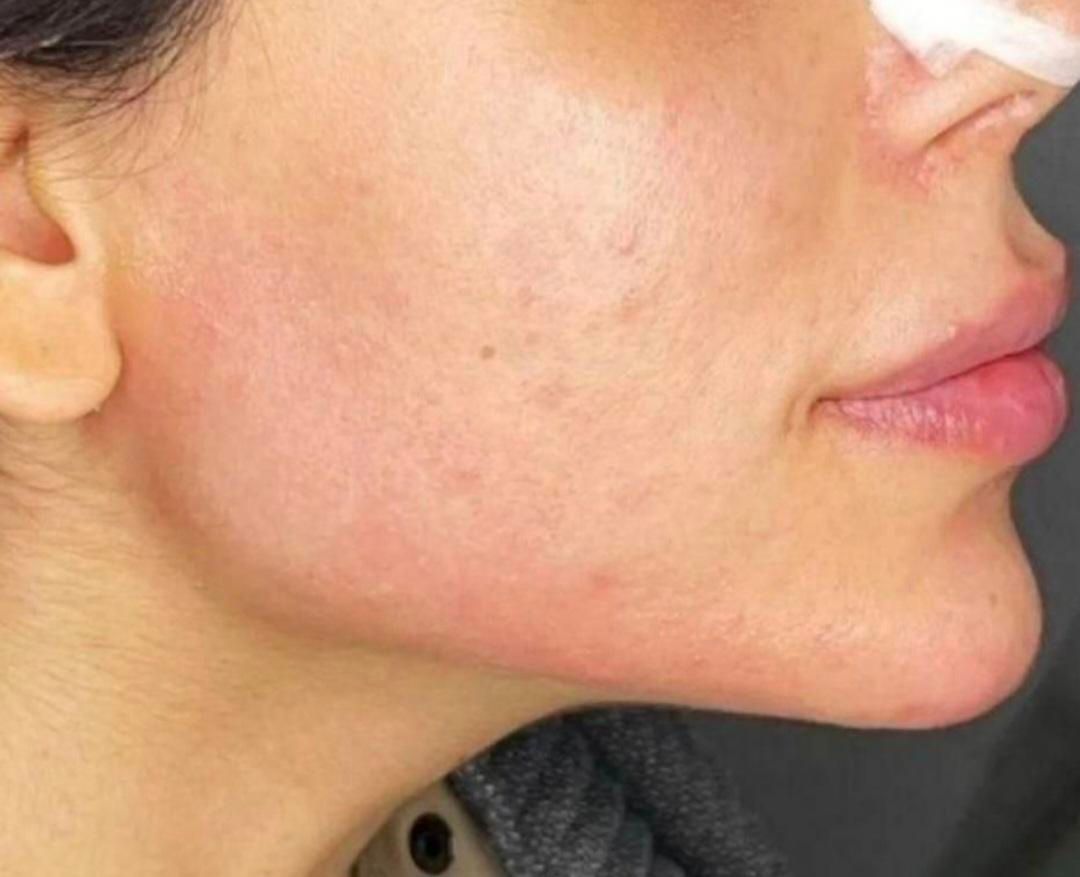 ژل،بوتاکس،فیبروز،رژ دایم،اکستنشن مژه سالن ومنزلتون|خدمات آرایشگری و زیبایی|شیراز, مسلم|دیوار