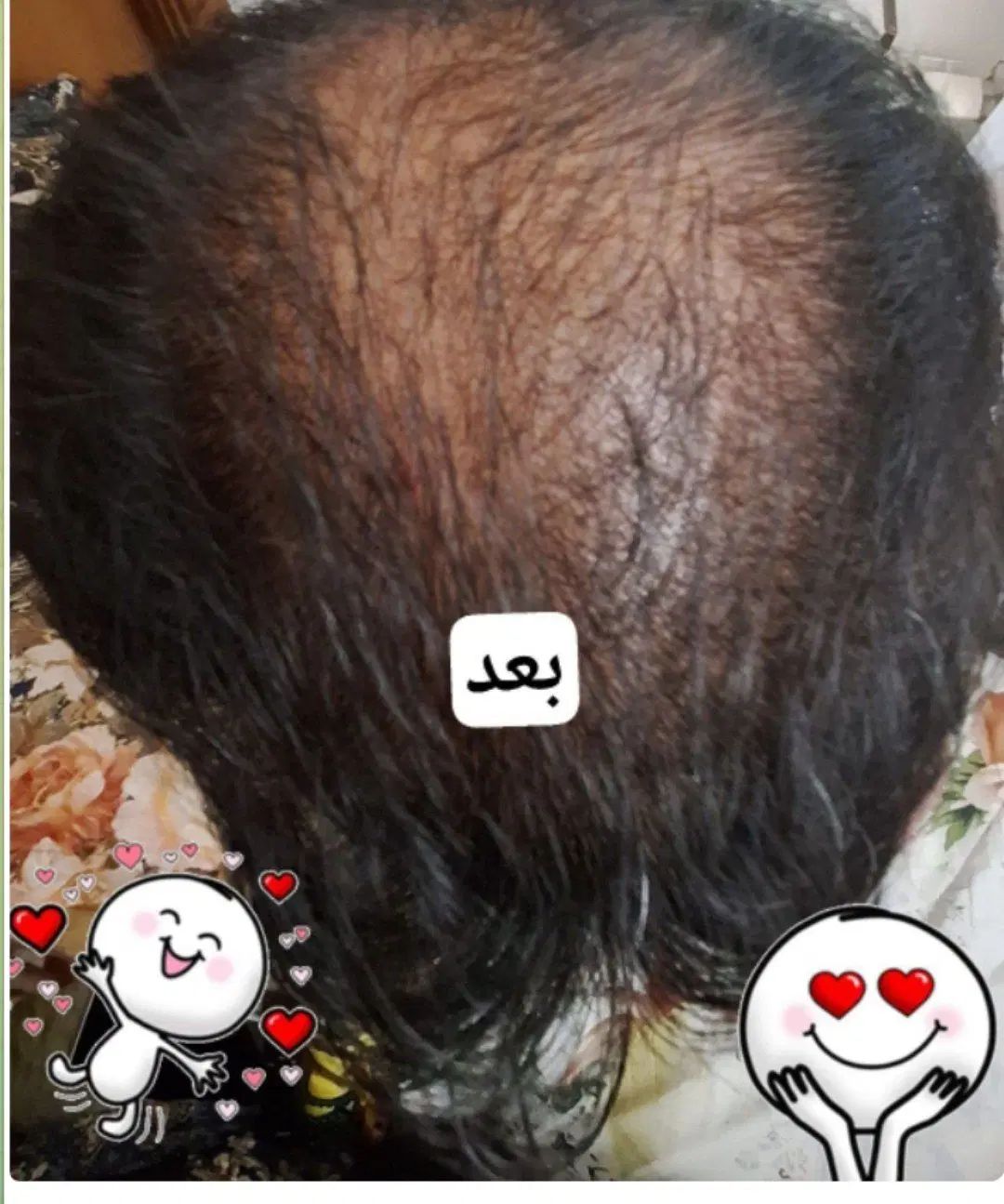 میخوای محصولی بهت معرفی کنم موههاتو تقویت کنه|آرایشی، بهداشتی، درمانی|ایلام, |دیوار