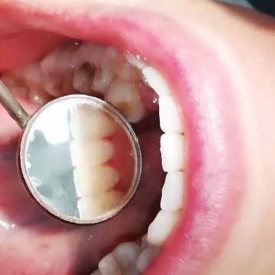 خدمات دندانپزشکی با نازلترین قیمت قسطی|خدمات آرایشگری و زیبایی|آباده, |دیوار
